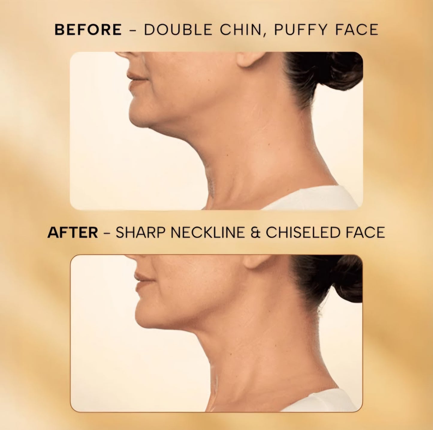 Skin Lift Electric Facial & Neck Massager
